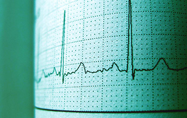 12-Lead ECG Interpretation